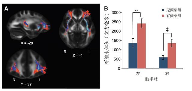 聽音樂起雞皮疙瘩？你可能真的天賦異稟