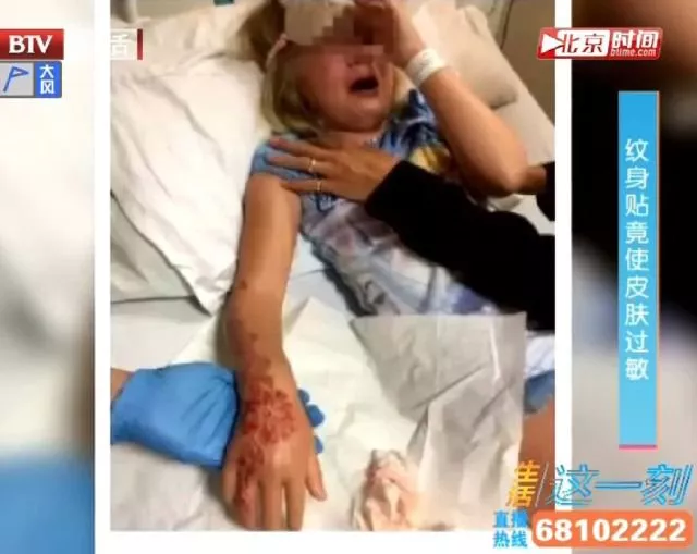 紋身貼檢測出“汞”？這些危險想不到！