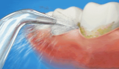 牙不干凈不夠白 哪還有自信去撩妹撩漢？