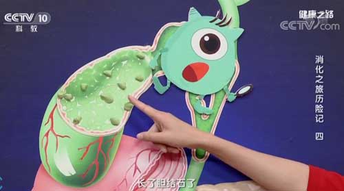 小石頭大危害！膽囊結(jié)石要不注意就變膽囊癌