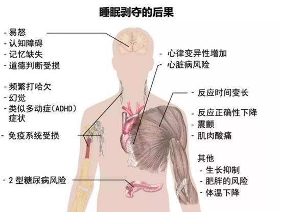 大學(xué)生連續(xù)熬夜后長出“毛尾巴” 醫(yī)生：罕見