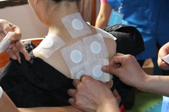 三伏貼每個(gè)人貼的中藥都一樣嗎？三伏貼貼的位置在哪里？