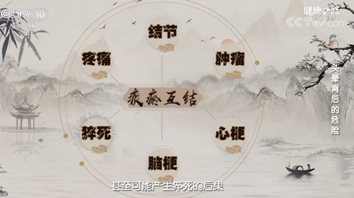 【名醫話健康】可別輕視痰瘀互結！會導致猝死！有這些習慣的人更要重視