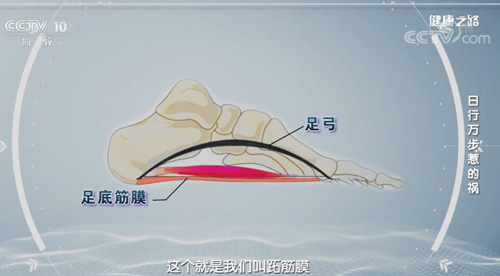 【名醫話健康】日行萬步惹的禍！你的腳后跟疼痛是因為它嗎？