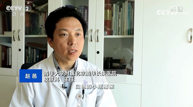 【快看·健康】眼周長脂肪粒是護膚品太過營養嗎？