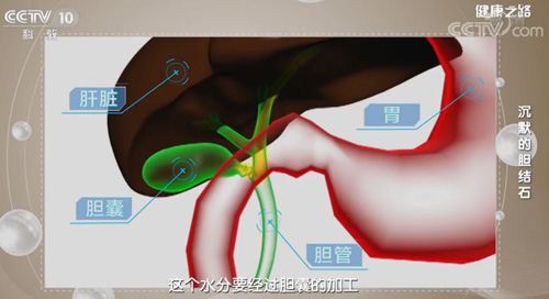 【名醫(yī)話健康】膽結(jié)石是怎樣形成的？除了長(zhǎng)期不吃早餐，還有這些原因……