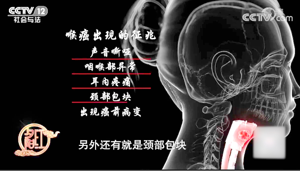 【快看·健康】喉癌出現的征兆有哪些？