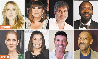 減肥要適度！脂肪流失會導致“節食臉”